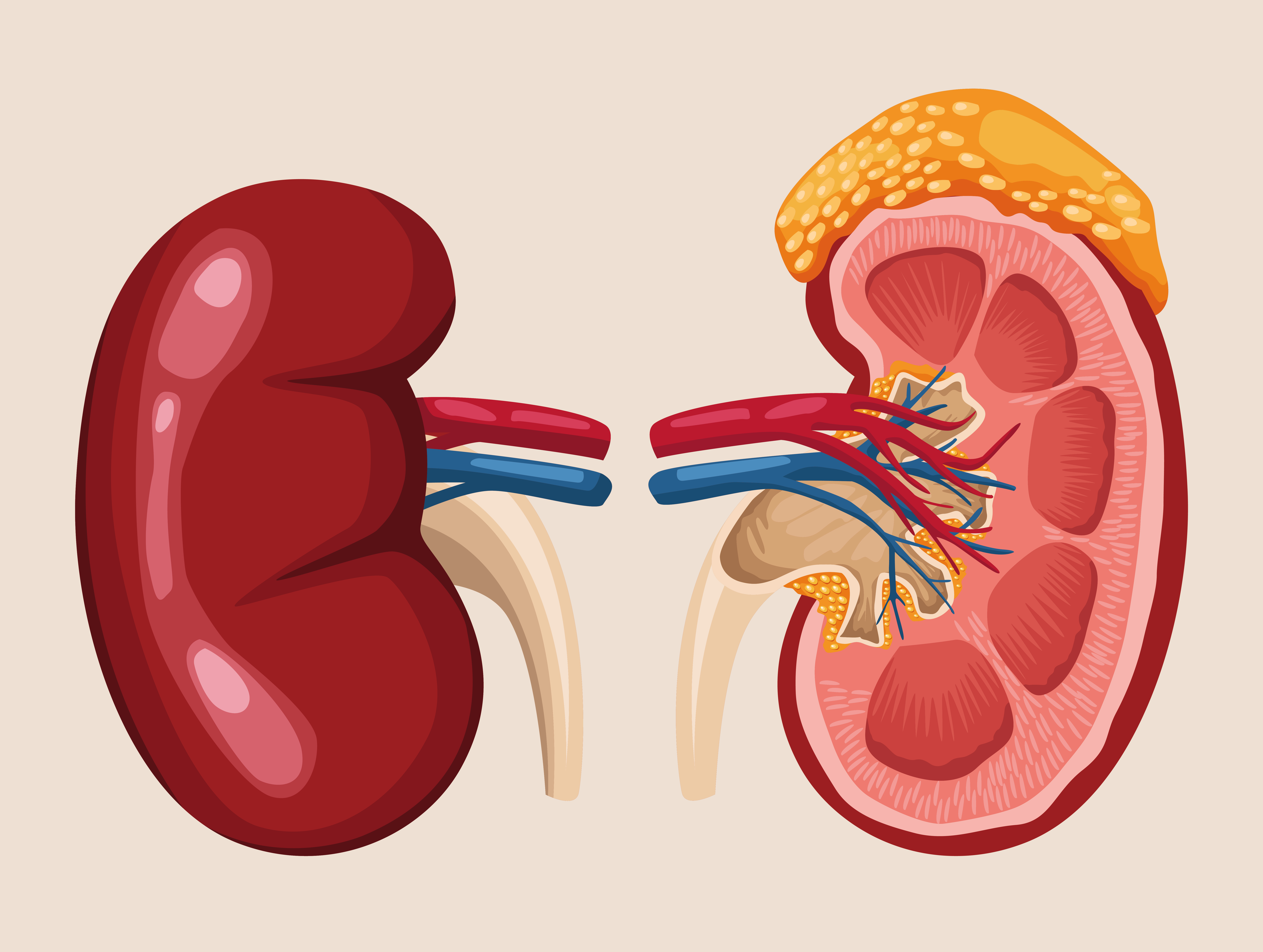 Diabetic Kidney Disease Diabetic Kidney Disease