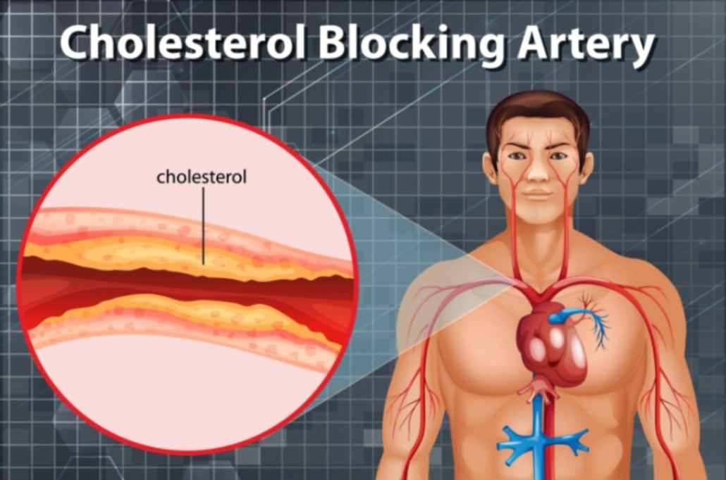 Cholesterol