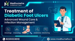 Treatment Diabetic Foot Ulcers